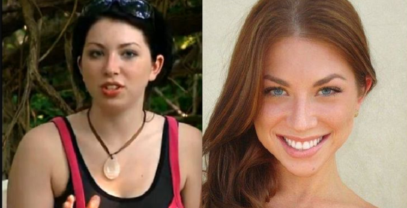 Did Stassi Schroeder Get Plastic Surgery